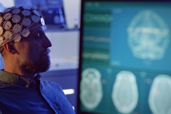 Intelligenza artificiale e medicina, il modello per monitorare il cervello in terapia intensiva