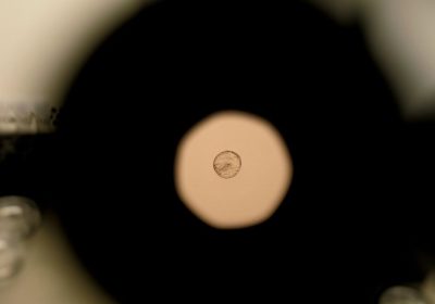 Embrione umano, siamo riusciti a filmare l’impianto per la prima volta