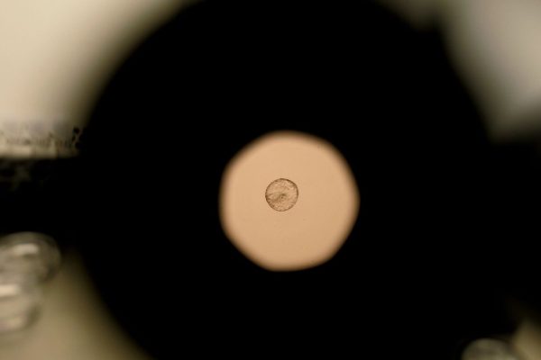 Embrione umano, siamo riusciti a filmare l’impianto per la prima volta