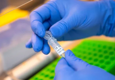 Garlasco, il Dna sotto e unghie di Chiara Poggi mostrerebbe una compatibilità con la linea maschile di Sempio