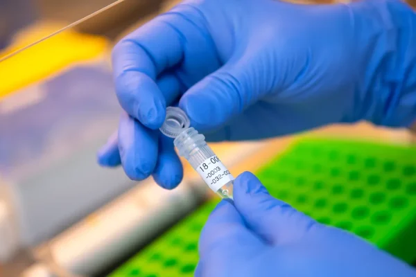 Garlasco, il Dna sotto e unghie di Chiara Poggi mostrerebbe una compatibilità con la linea maschile di Sempio