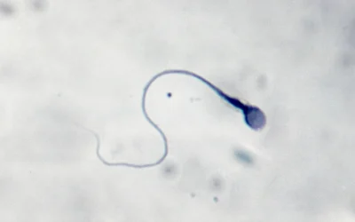 La prima gravidanza al mondo ottenuta grazie all’intelligenza artificiale capace di scovare gli spermatozoi vitali (e a un robot)