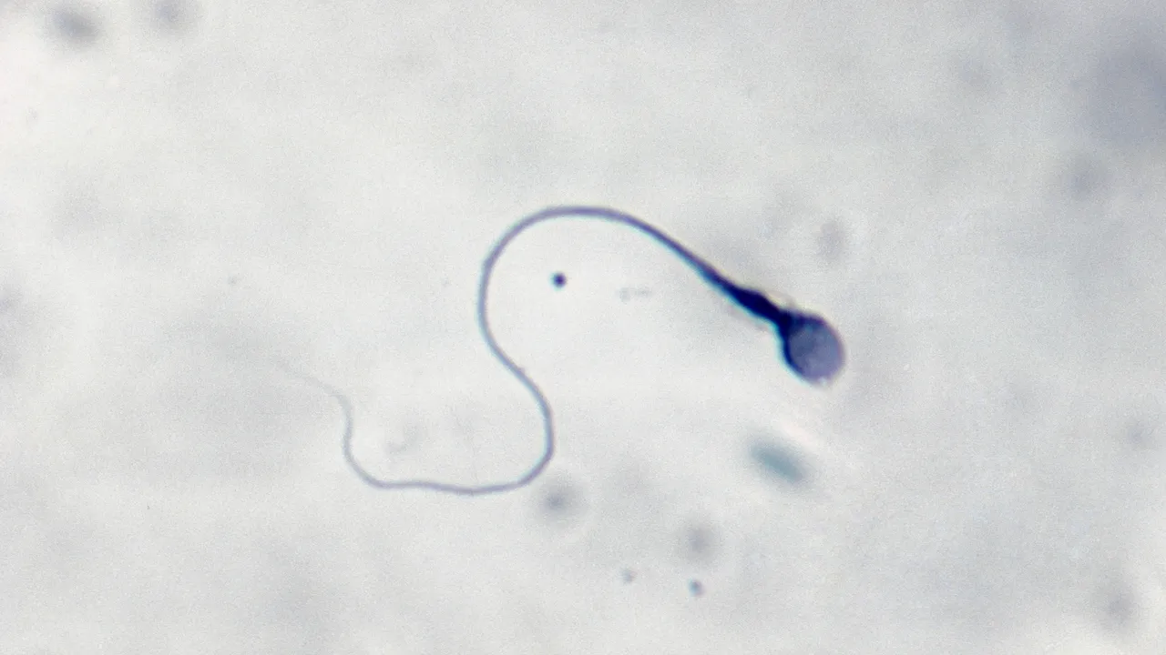 La prima gravidanza al mondo ottenuta grazie all’intelligenza artificiale capace di scovare gli spermatozoi vitali (e a un robot)