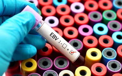 La causa del lupus eritematoso sistemico è stata finalmente scoperta e si tratta di un virus che quasi tutti noi abbiamo latente