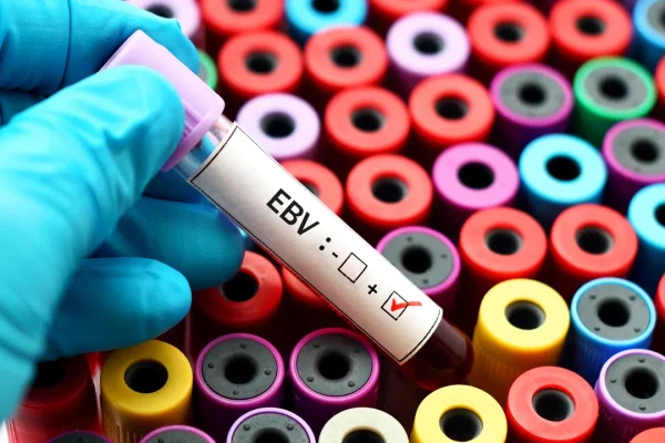 La causa del lupus eritematoso sistemico è stata finalmente scoperta e si tratta di un virus che quasi tutti noi abbiamo latente