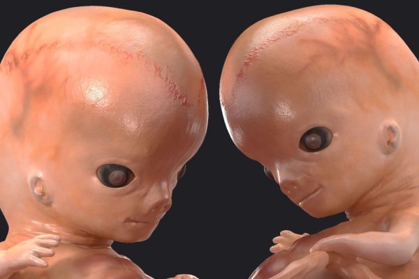Bambini su misura? Il caso della startup Preventive – che piace ai miliardari della Silicon Valley