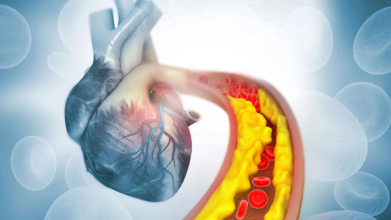 Terapia genica 'one-shot' abbatte colesterolo e trigliceridi: prima sperimentazione umana riuscita