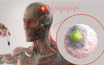Una sola iniezione per curare Alzheimer e depressione: il progetto del MIT entro 3 anni