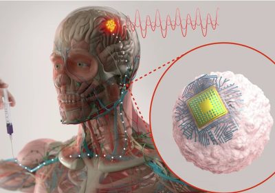 Una sola iniezione per curare Alzheimer e depressione: il progetto del MIT entro 3 anni