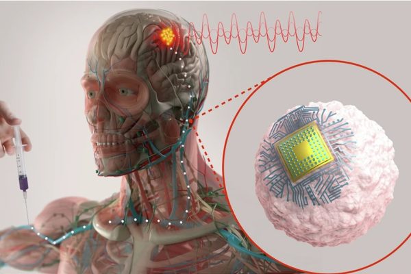 Una sola iniezione per curare Alzheimer e depressione: il progetto del MIT entro 3 anni
