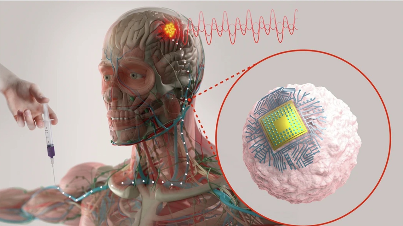 Una sola iniezione per curare Alzheimer e depressione: il progetto del MIT entro 3 anni