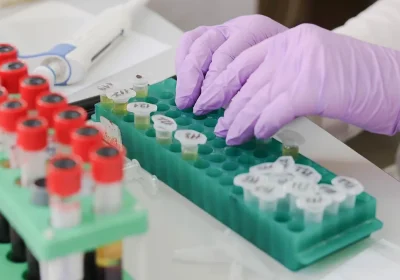 Dal dono alla terapia: l’evoluzione della filiera del plasma tra ricerca, impresa e salute