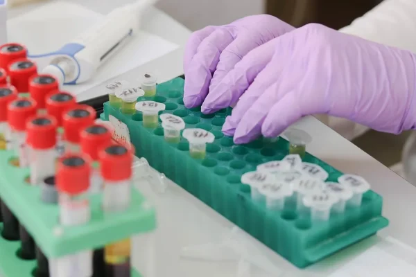 Dal dono alla terapia: l’evoluzione della filiera del plasma tra ricerca, impresa e salute