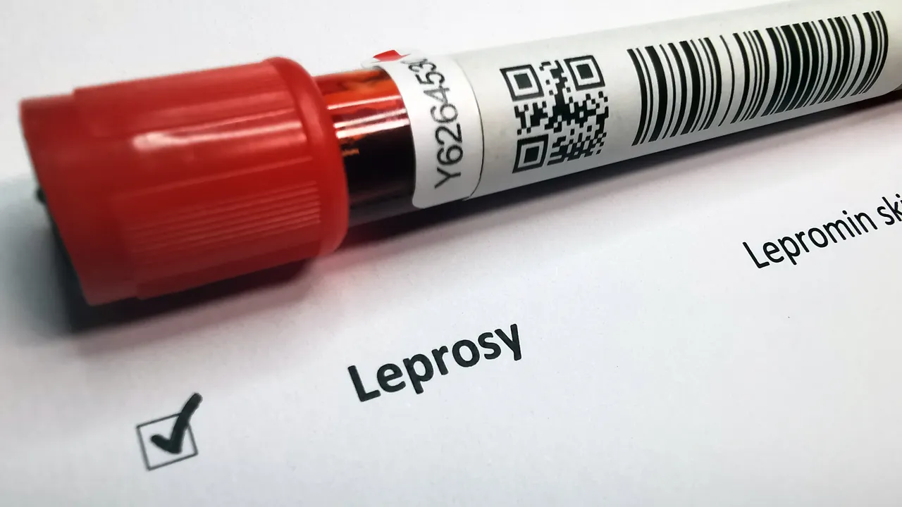 Casi di lebbra sono stati segnalati in Romania e Croazia, come si manifesta la malattia (e in Italia è diffusa?)