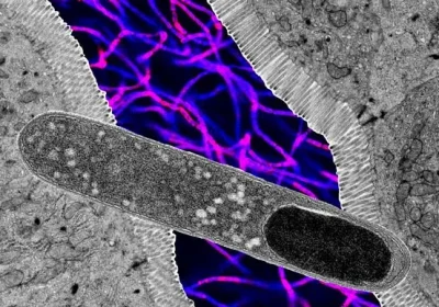 C’è un batterio intestinale talmente potente che da solo riesce ad impedire l’aumento di peso (anche con una dieta ricca di grassi)