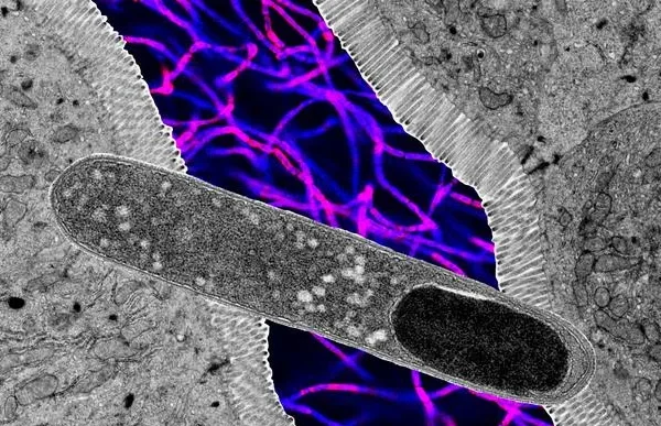 C’è un batterio intestinale talmente potente che da solo riesce ad impedire l’aumento di peso (anche con una dieta ricca di grassi)