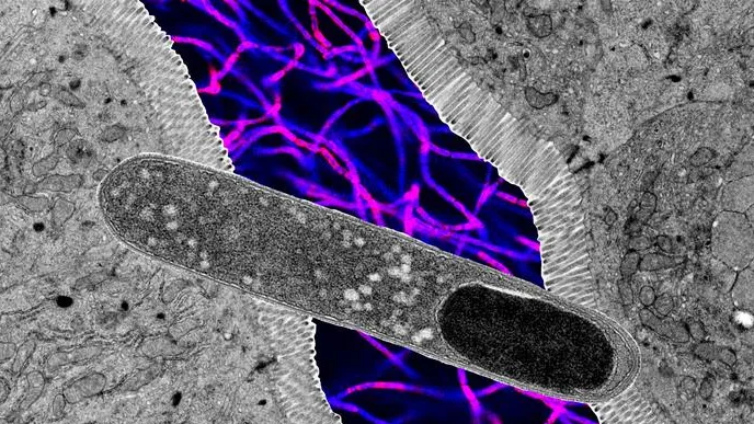 C’è un batterio intestinale talmente potente che da solo riesce ad impedire l’aumento di peso (anche con una dieta ricca di grassi)