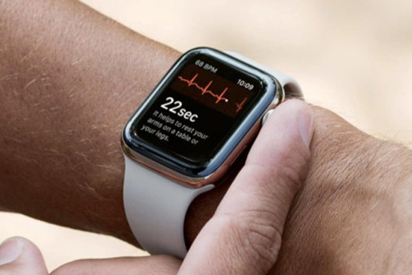 Aritmie cardiache, cresce il numero di casi scoperti grazie agli smartwatch
