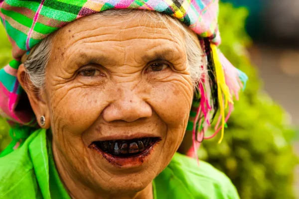 Altro che sbiancamento, nel Vietnam dell’età del ferro andava di moda un sorriso tutto denti neri e lucidi
