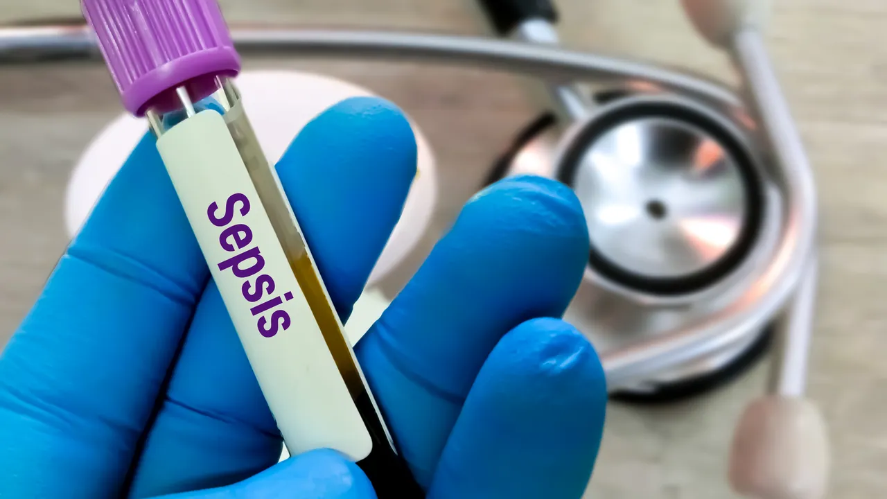 Individuare la sepsi è una corsa contro il tempo e oggi con un esame del sangue si può riconoscere più rapidamente il rischio
