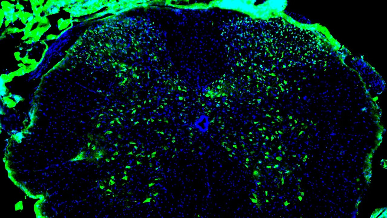 Dallo studio dei tumori spunta una nuova strada per per la riparazione del midollo spinale