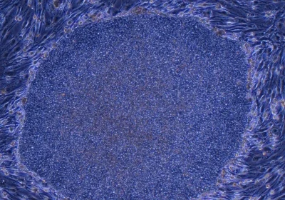 Staminali pluripotenti indotte, il Giappone ha approvato per la prima volta due trattamenti basati su cellule umane riprogrammate