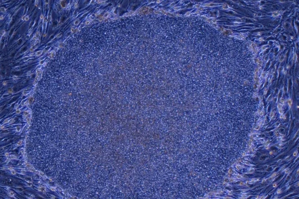 Staminali pluripotenti indotte, il Giappone ha approvato per la prima volta due trattamenti basati su cellule umane riprogrammate