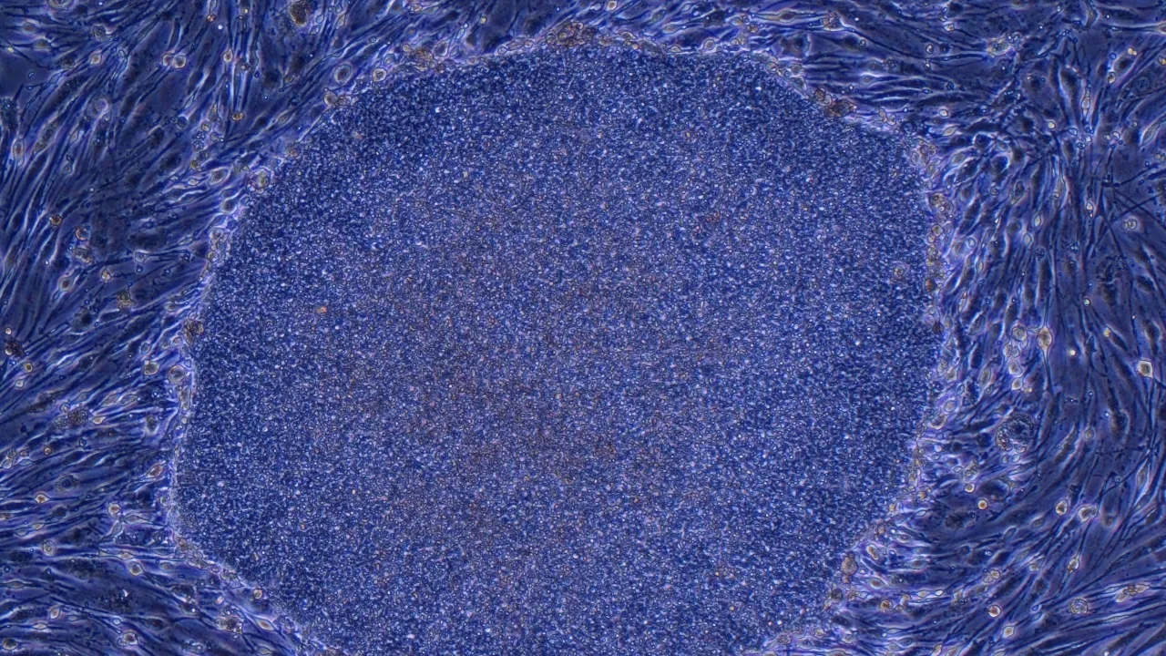 Staminali pluripotenti indotte, il Giappone ha approvato per la prima volta due trattamenti basati su cellule umane riprogrammate