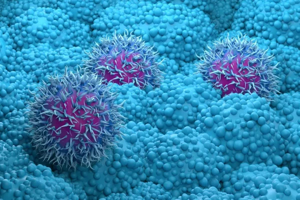 Il farmaco sperimentale daraxonrasib per il tumore del pancreas ha raddoppiato la sopravvivenza in uno studio clinico di fase III