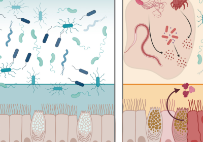Una proteina naturale per difendere l’intestino dalle infezioni