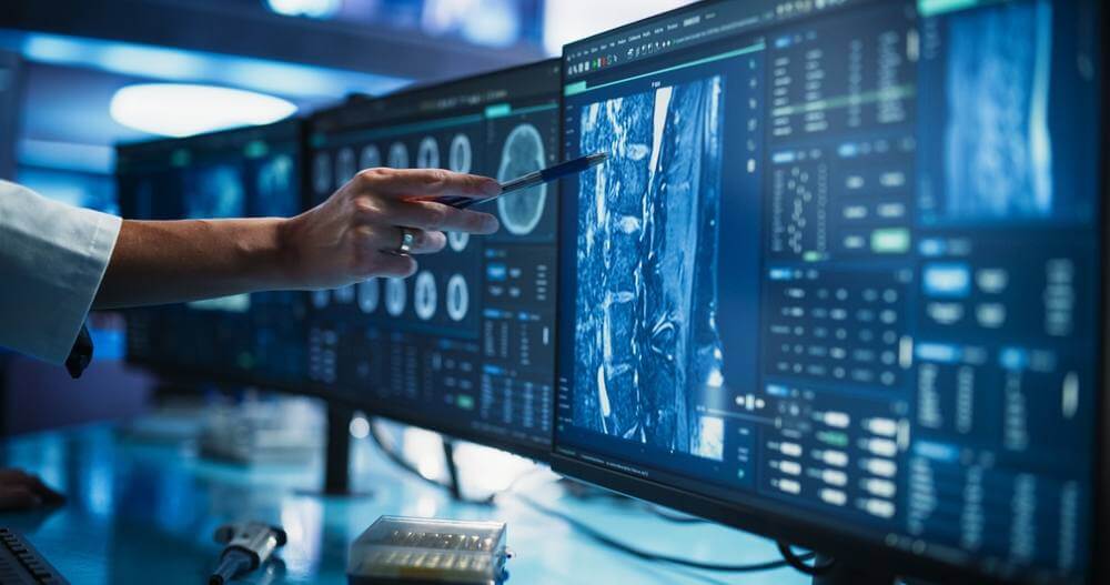 Integrazione dell’AI in Radiologia: Svela i Vantaggi Reali