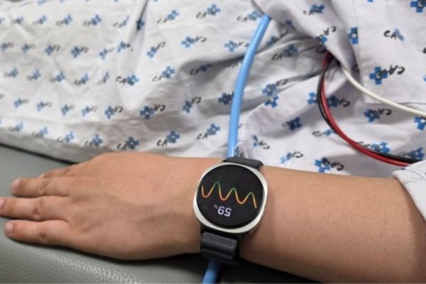 Gli smartwatch Samsung: come l’AI può prevenire gli svenimenti