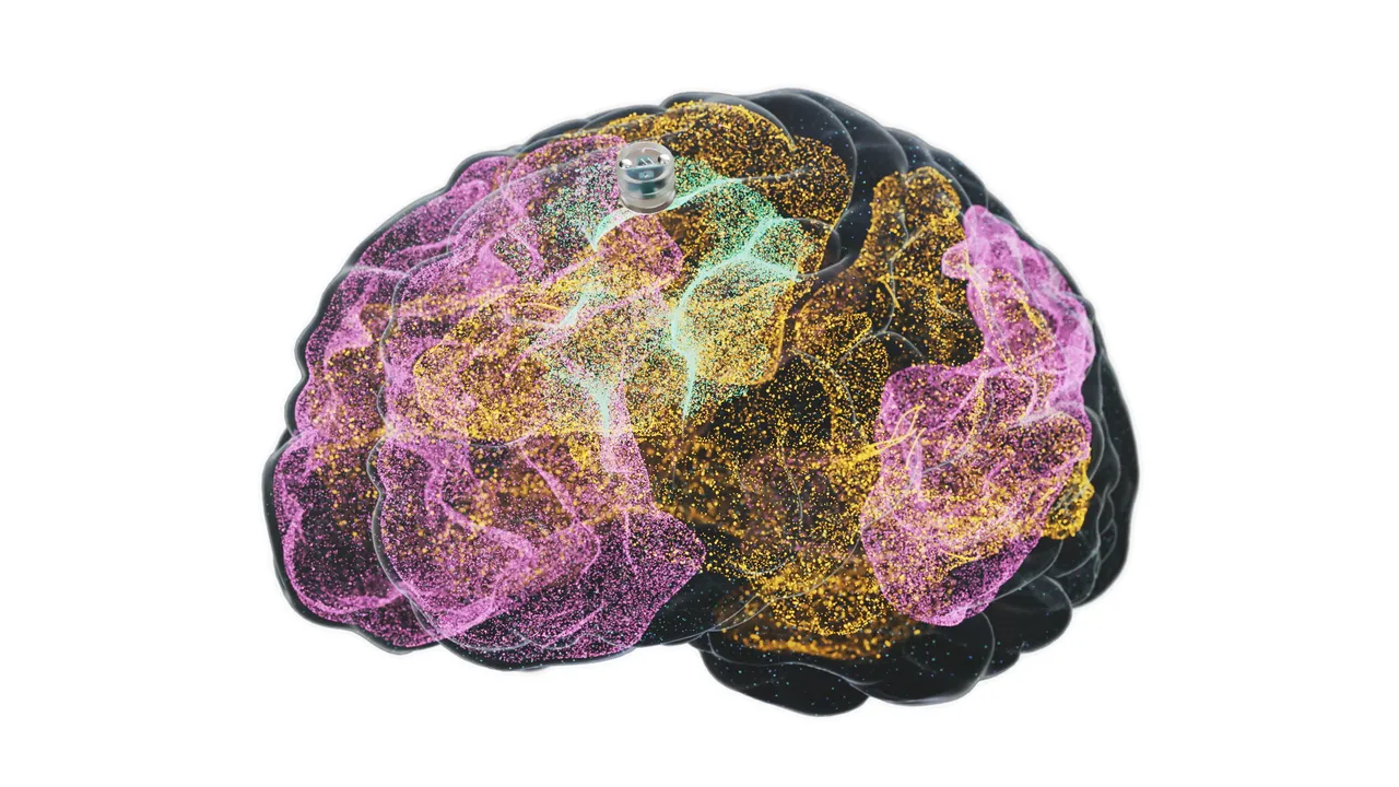 Depressione: gli impianti cerebrali come possibile soluzione innovativa?