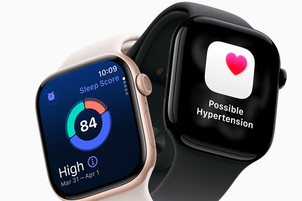 Apple Watch sfida Garmin, Oura e Whoop: scopri la nuova funzionalità Readiness