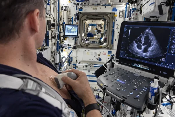 Il cuore umano si adatta ai mesi nello spazio: potrà resistere su Marte?